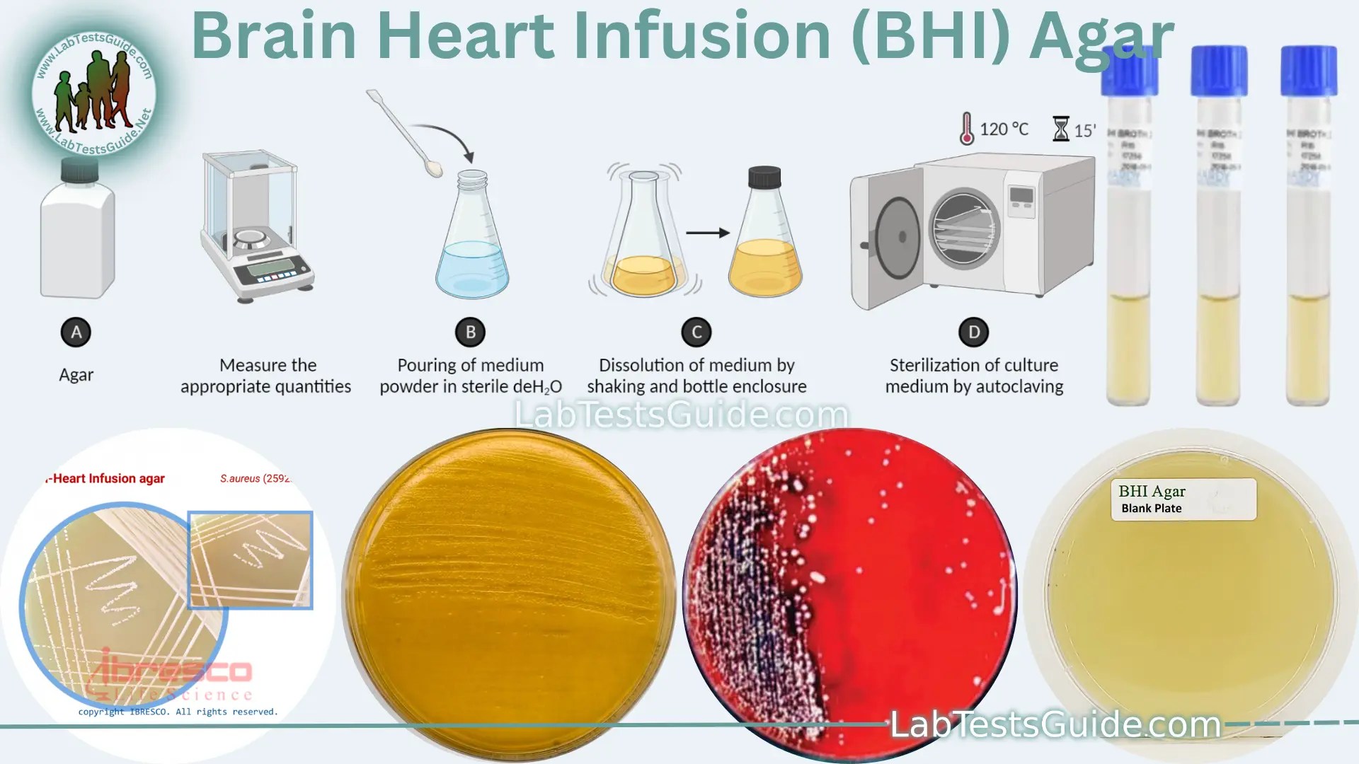Brain Heart Infusion (BHI) Agar Purpose, Principles, Composition
