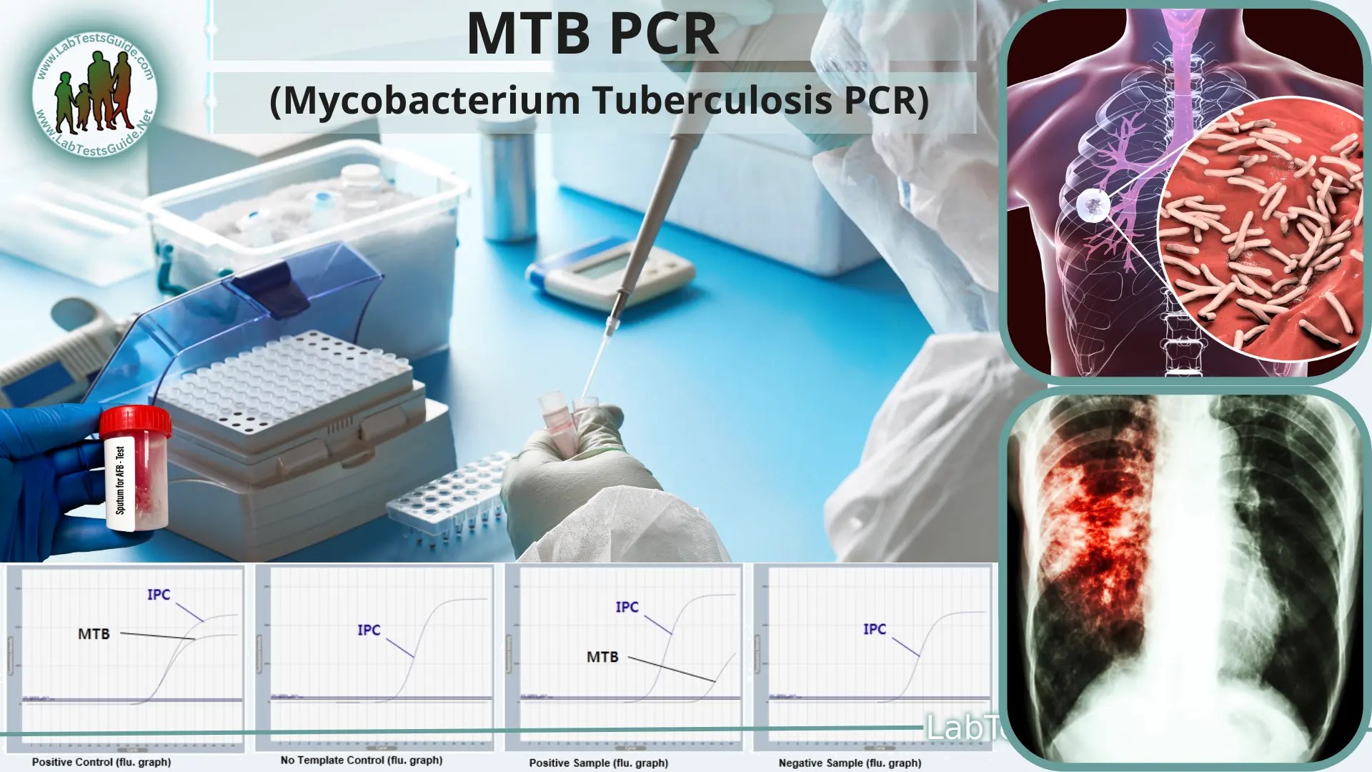 MTB PCR Purpose, Procedure, Principles, Result, 50 OFF