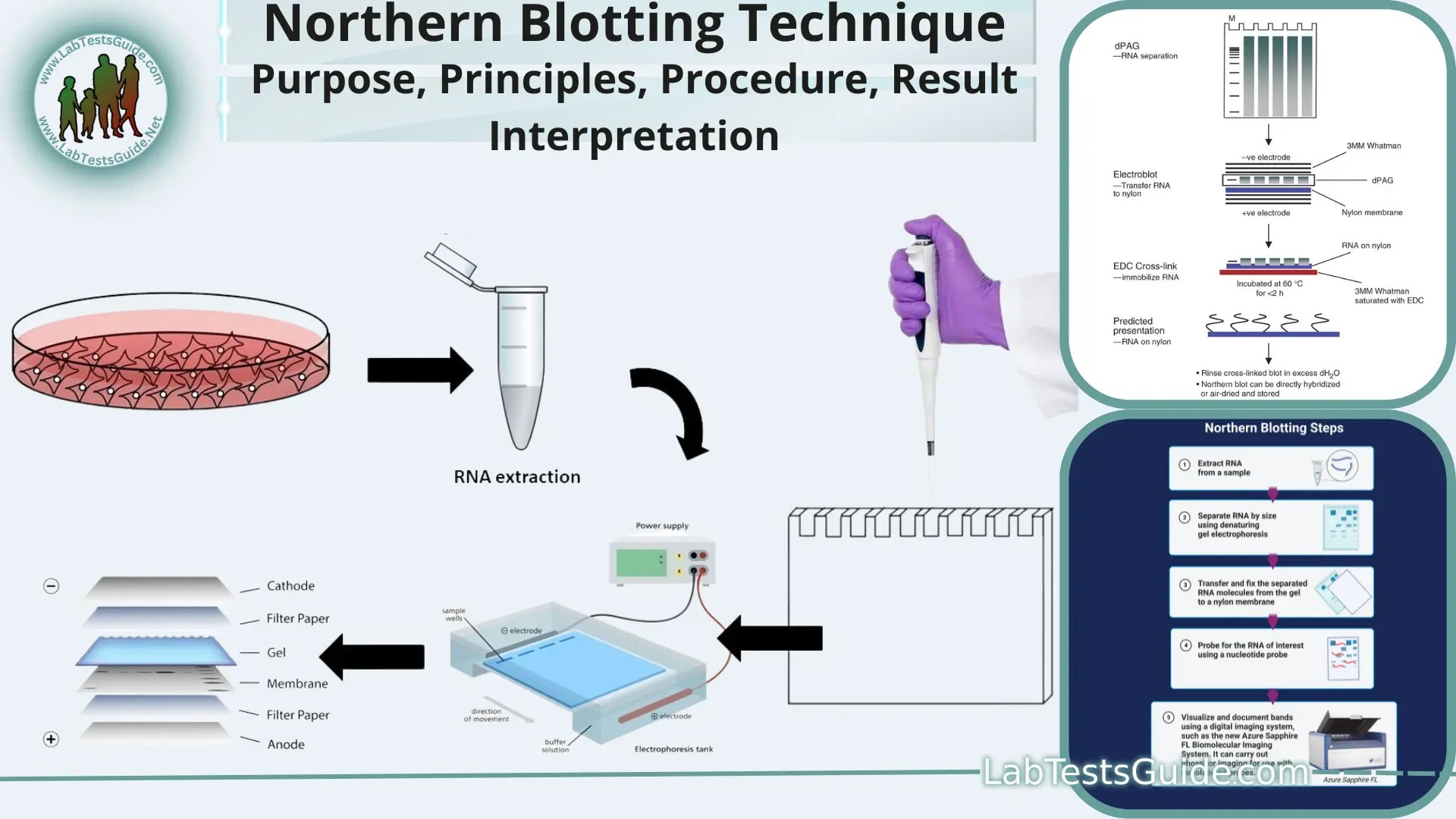 Northern Blotting (RNA Blotting) Lab Tests Guide