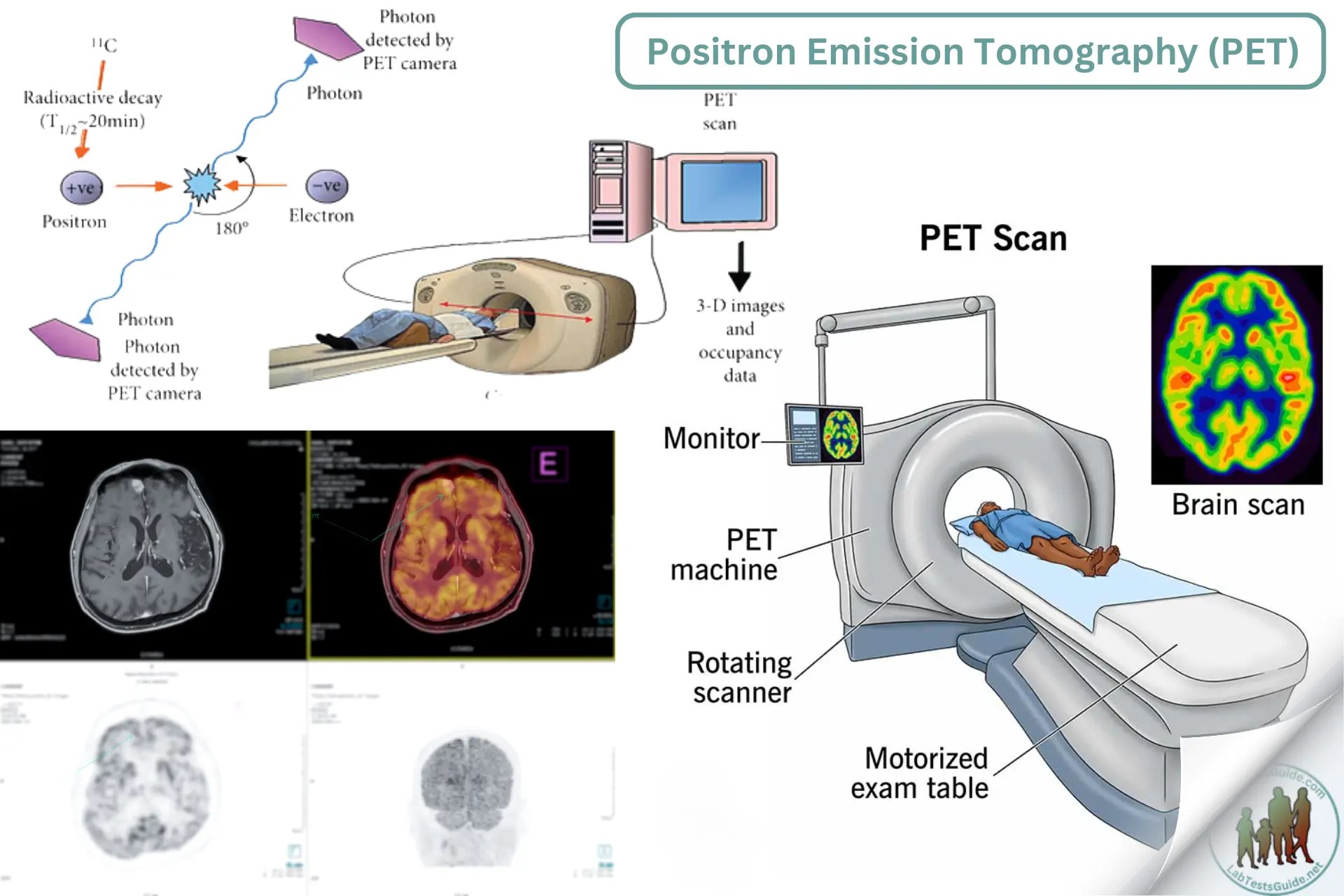 Positron Emission Tomography (PET) Principle, Purpose, Requirements