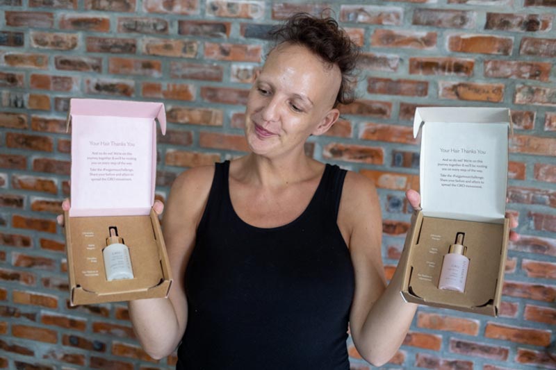 Vegamour Reviews 2023 My Top Hair Loss Serum Lady Alopecia