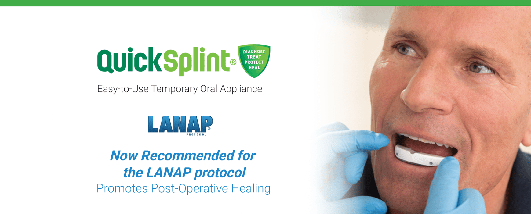 Adding QuickSplint to Your LANAP Treatment Routine Millennium Dental