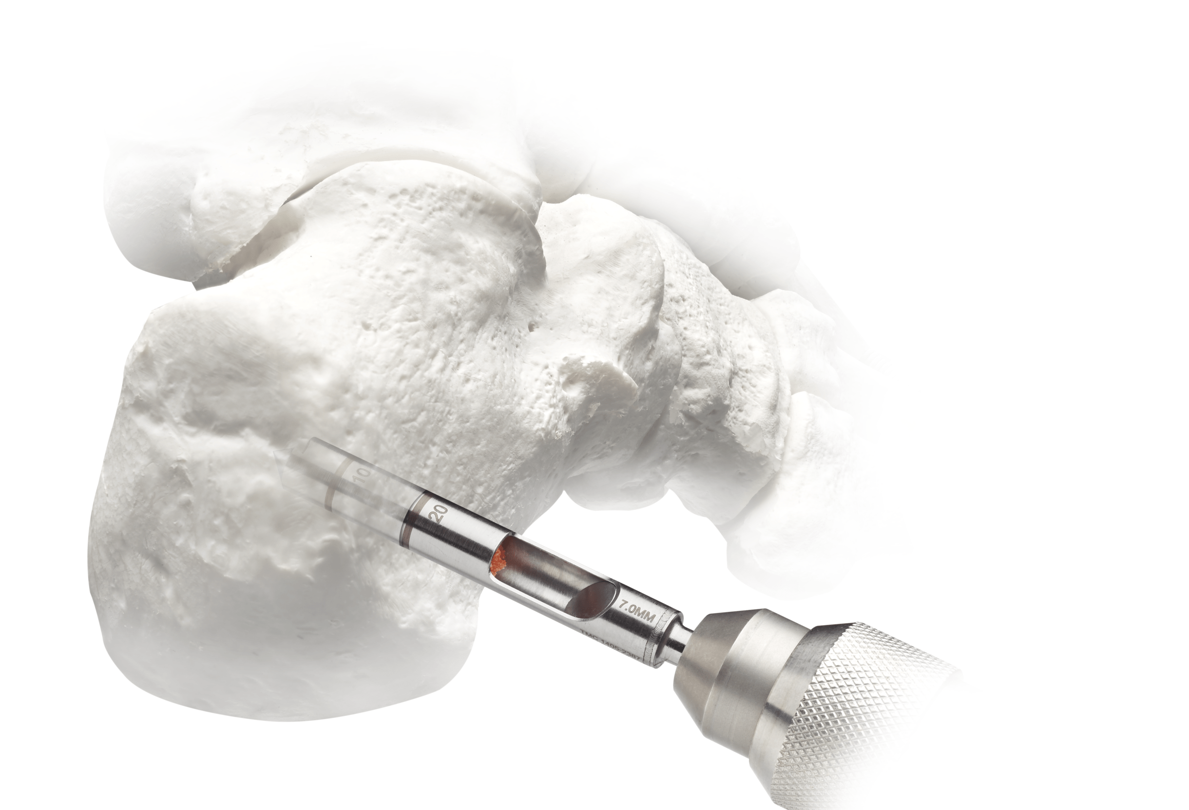 FastGrafter® Autograft Harvesting System Treace Medical Concepts, Inc.