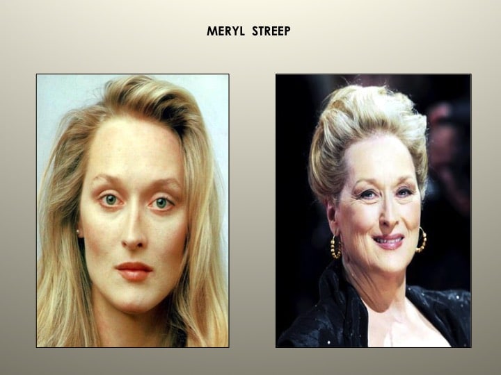 How Celebrities Age - Wayne Larrabee Md