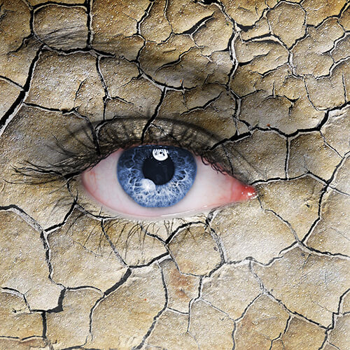 Dry Eye Beverly Hills Dry Eye Treatment Los Angeles, CA