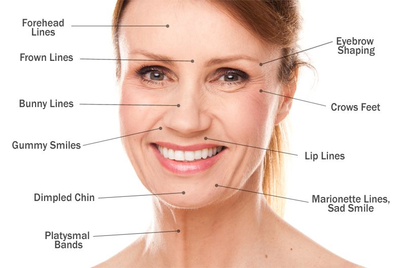 Wrinkle Relaxers Laser Skin Care