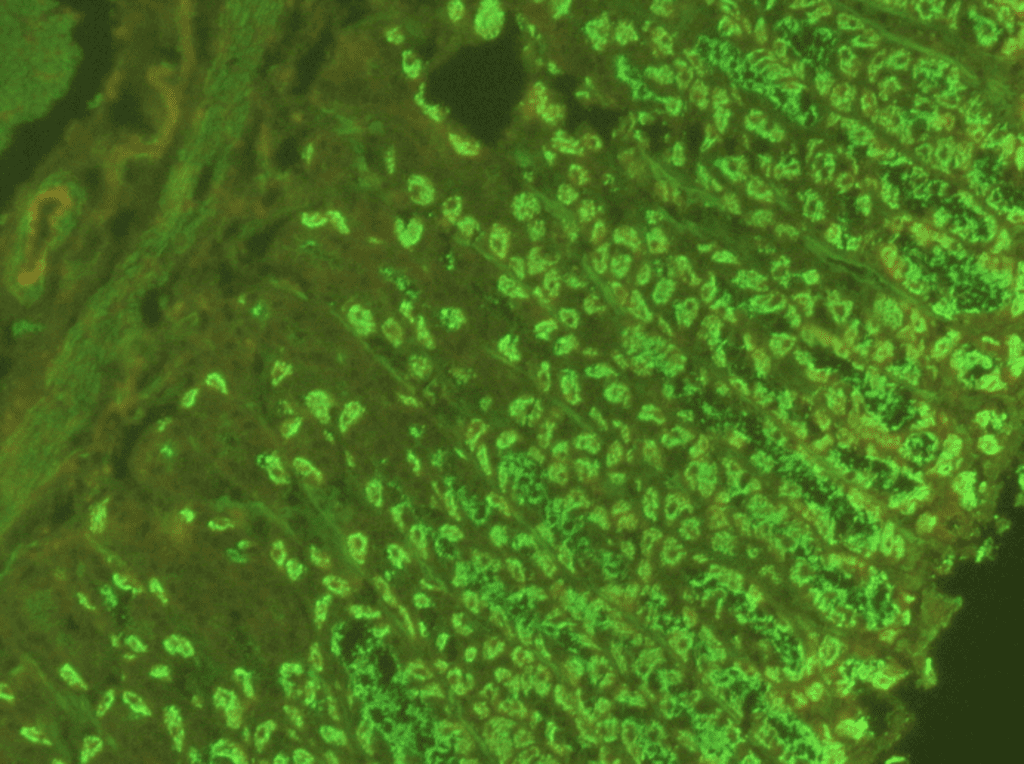 Antiparietal cell antibodies (APCA) Positive control Launch Diagnostics