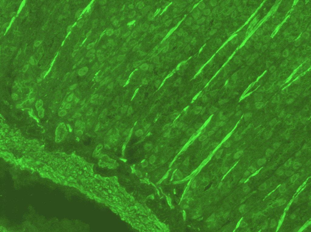 Antismooth muscle antibodies (ASMA) positive control Launch Diagnostics