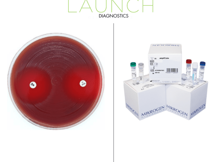 Giardia Lamblia Antigen EIA Launch Diagnostics