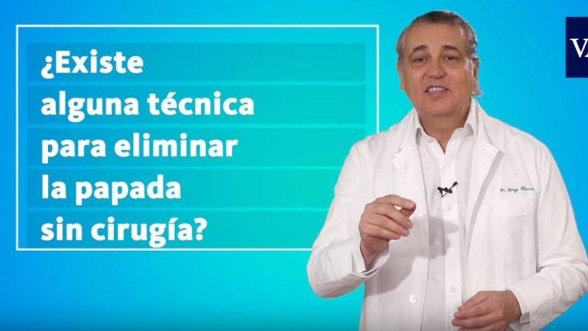¿Se puede eliminar la papada sin cirugía?