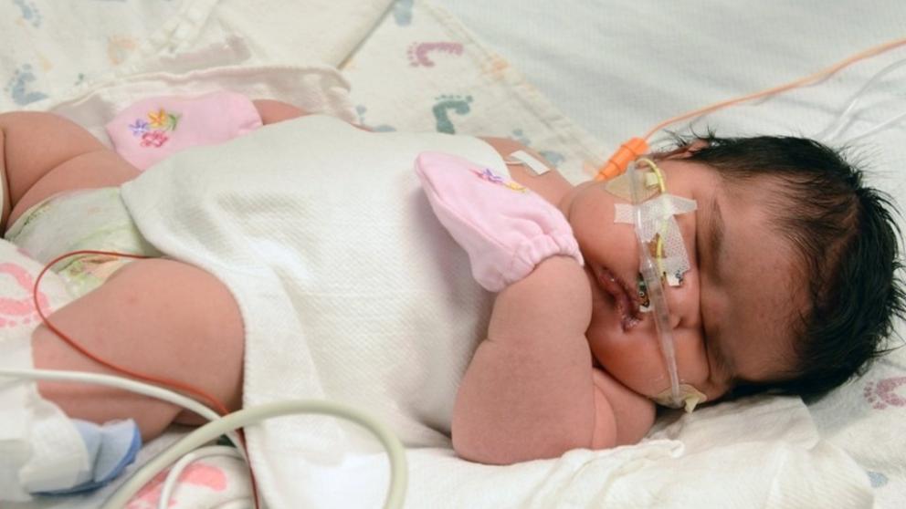 Nace una bebé de 6,2 kilos en un hospital de Estados Unidos