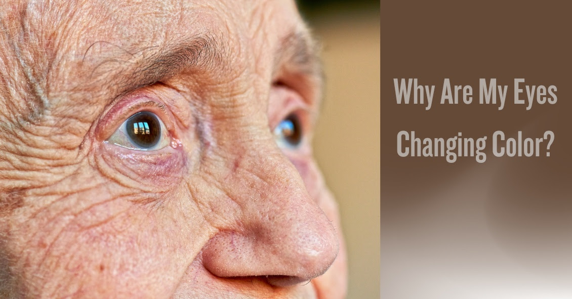 What is causing my eyes to change color? La Verne Optometry