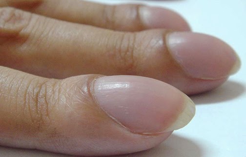 8 Advertencias de salud que tus uñas pueden estarte enviando