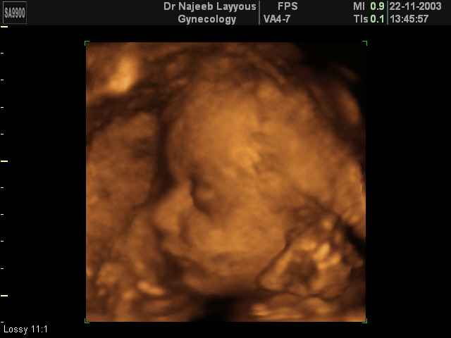 Seventh Month Pregnancy 7 months pregnant Dr N Layyous