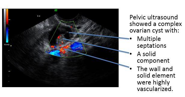 Bower Oncology Lecture Notes