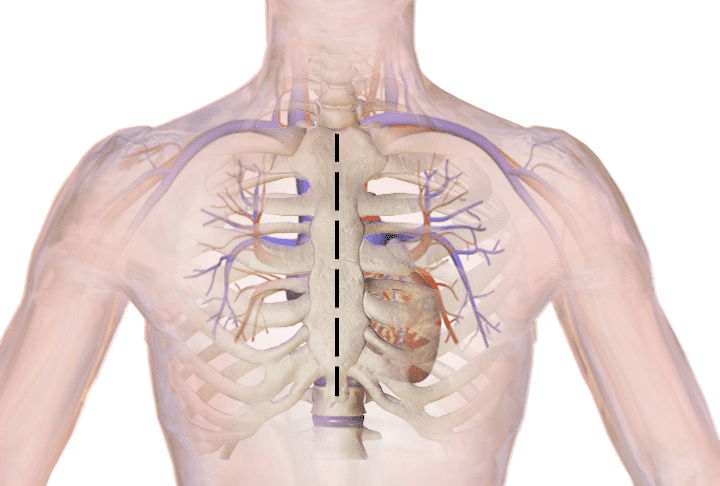 Open Heart Surgery Procedure, Risks, Precautions LeoGenic