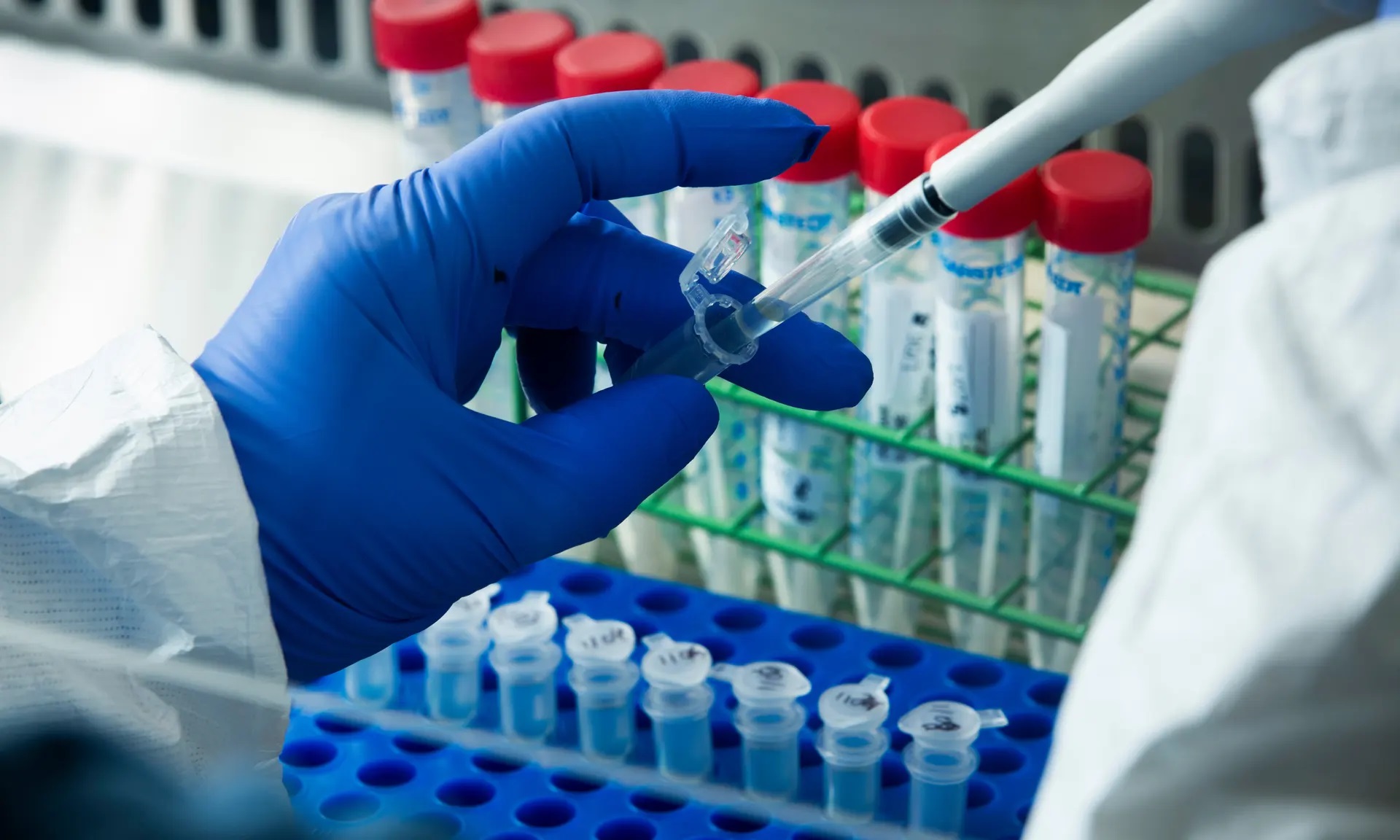 » Coronavirus les hôpitaux britanniques vont tester cinq nouveaux