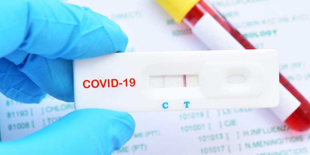 Un nouveau test précis et pas cher pour détecter la Covid