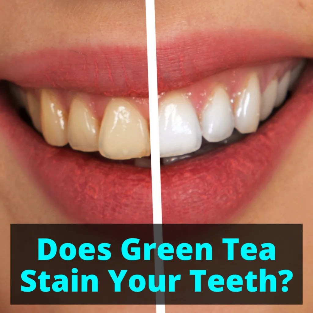 Does Green Tea Stain Your Teeth?