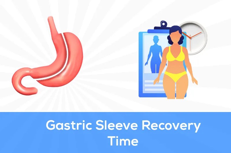 Gastric Sleeve Recovery Time How long does it take?