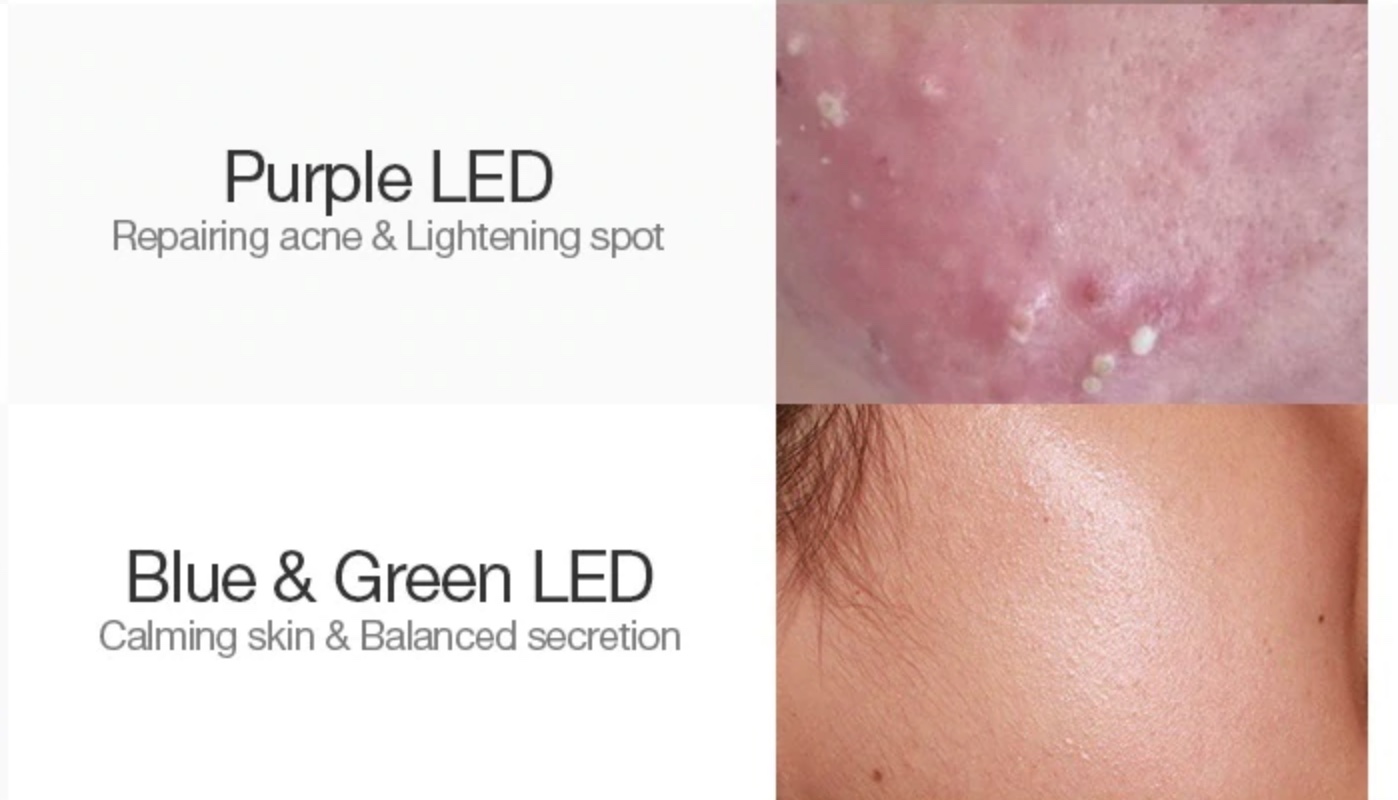 LED Light Therapy Facial L'Exquisite Day Spa For Women & Men