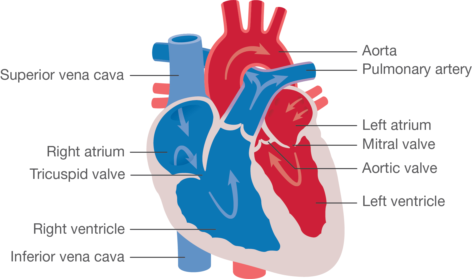 Pulmonary Atresia with intact ventricular septum Little Hearts Matter