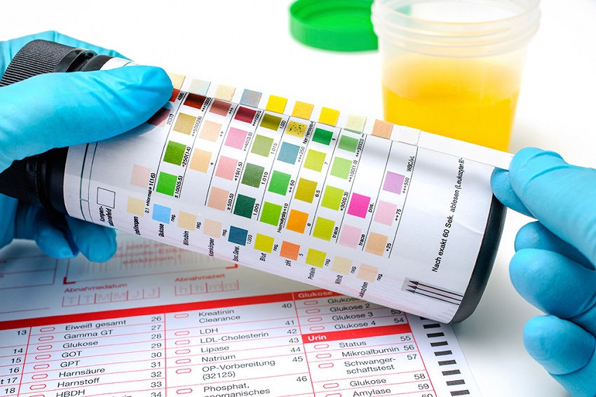 What Causes Blood in Urine 6 Possible Health Conditions