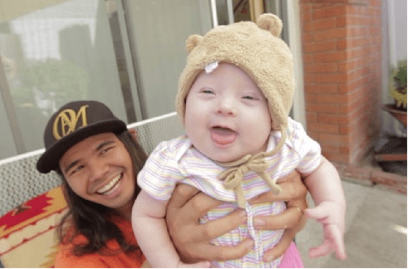 Open Hearts Couple Adopts Baby With Down Syndrome