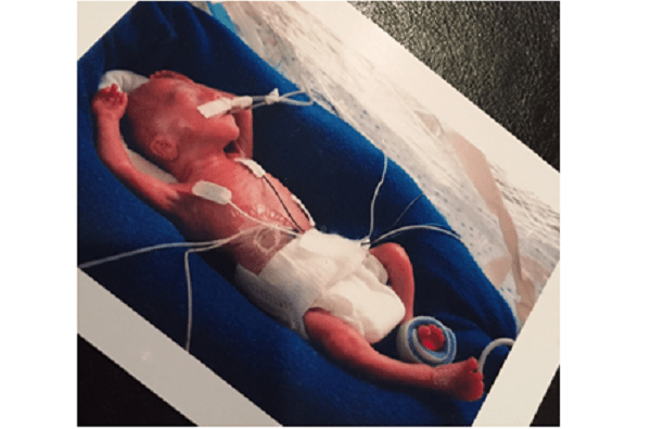 This Baby is the Face of 18,000 Unborn Babies the 20Week Abortion Ban