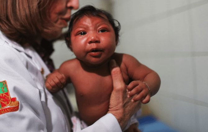 Three Babies With Disabilities Because of the Zika Virus May Have Already Been Aborted
