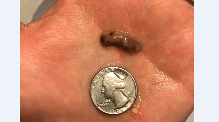 Parents Release Photos of Baby Miscarried at 5 Weeks to Show Humanity