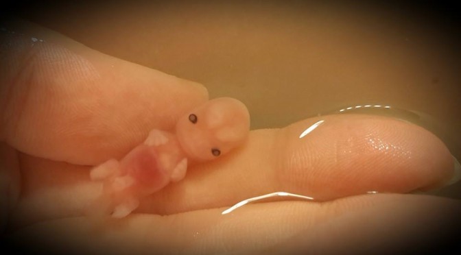 Miscarried at 7 and 8 Weeks, These Babies are Changing the Abortion