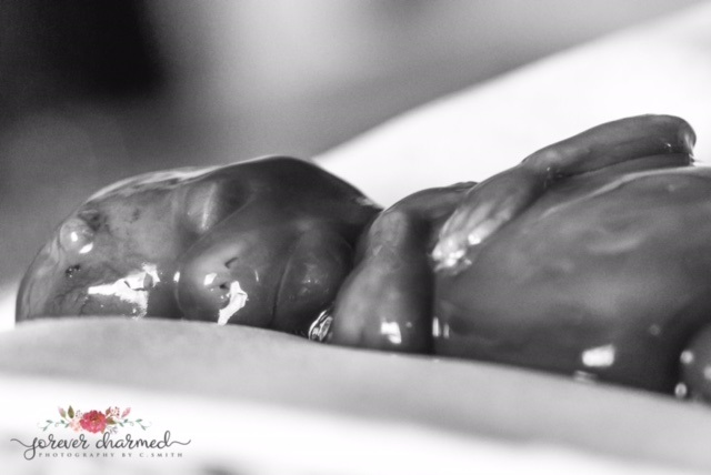 Mother Releases Photos of Daughter Miscarried at 17 Weeks to Help Stop