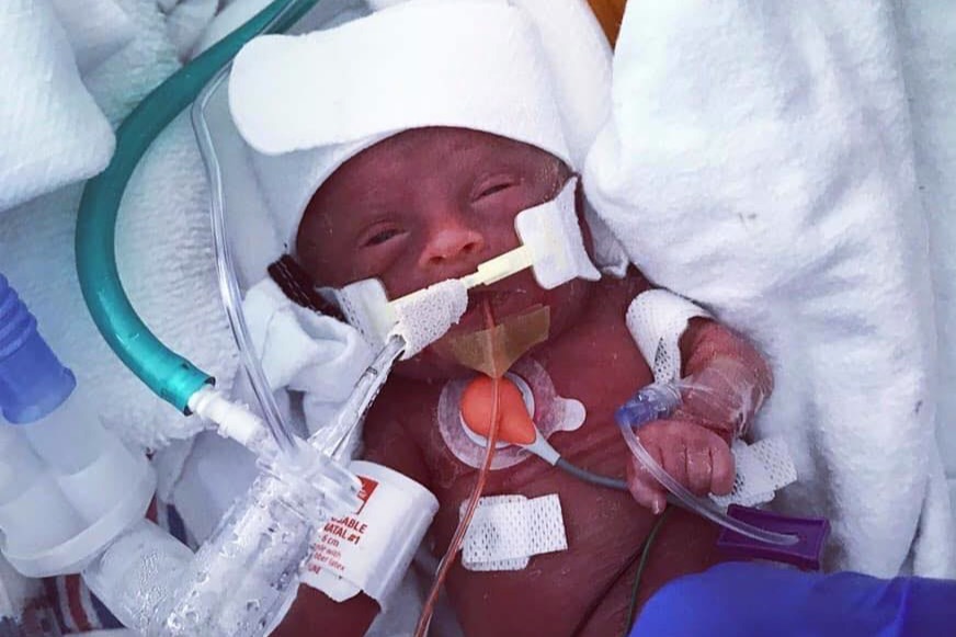 Miracle Baby Goes Home After He's Born Weighing 1 Pound, Feet Were the