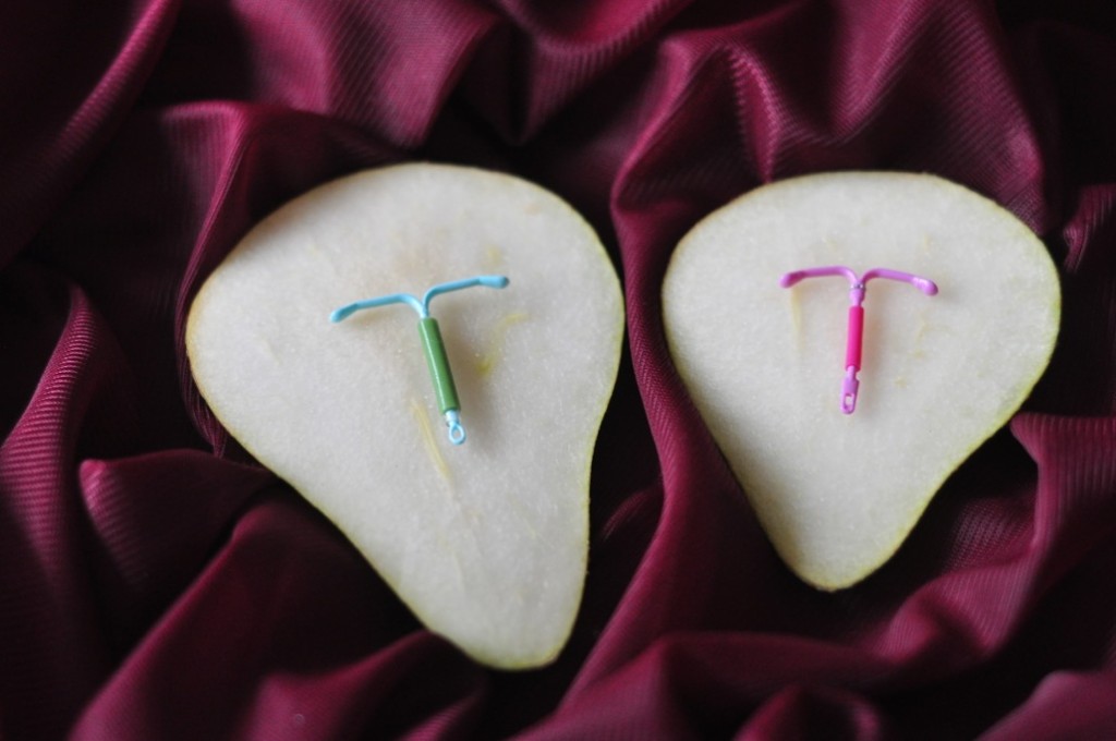 Mijn ervaring met de Mirena.