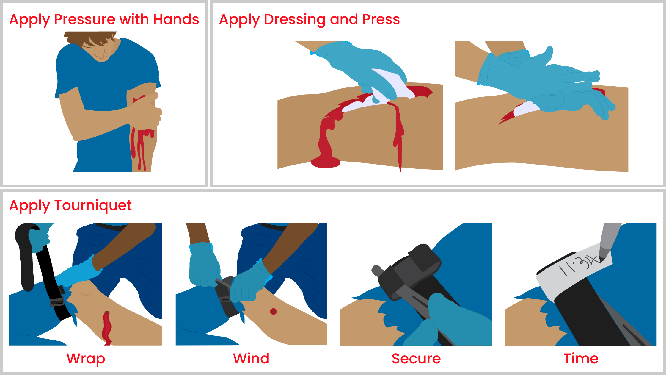 Stop the Bleed to Save Lives Answering Your Questions About Using