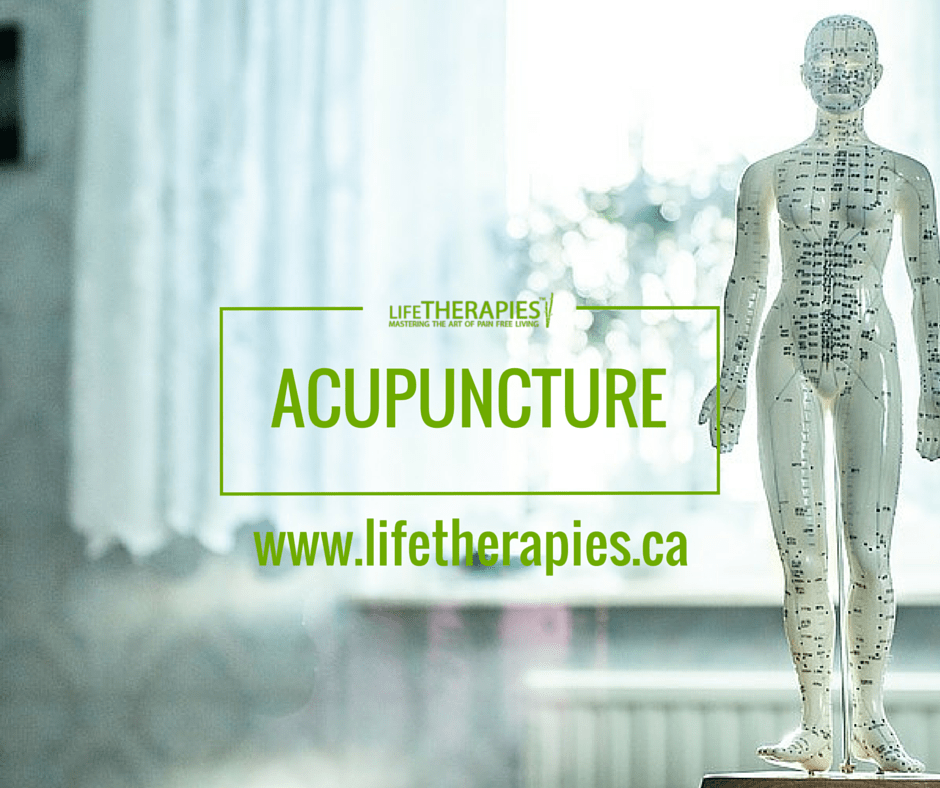 Acupuncture Offered At Ottawa's Life Therapies Clinic • Life Therapies