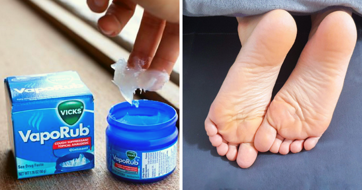Top 10 Home remedies for cracked heels and dry feet