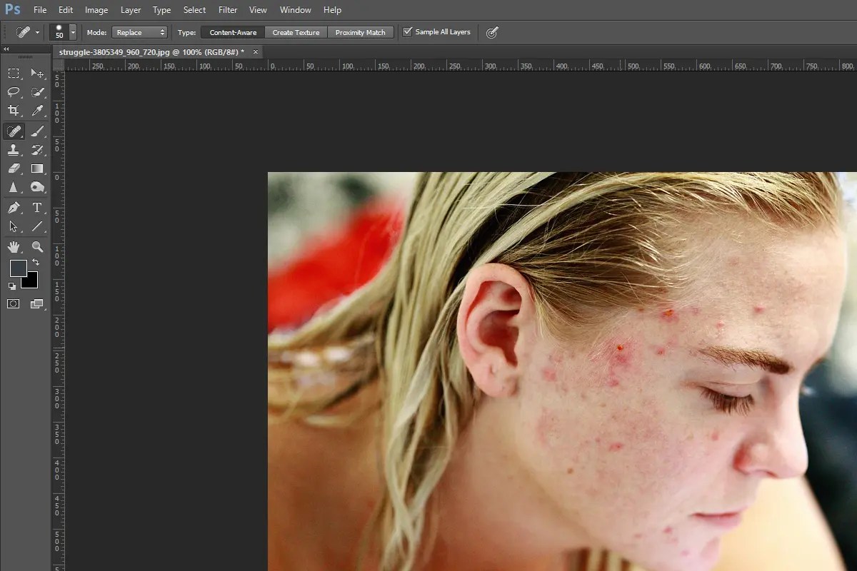 3 Ways To Remove Skin Blemishes In Light Stalking