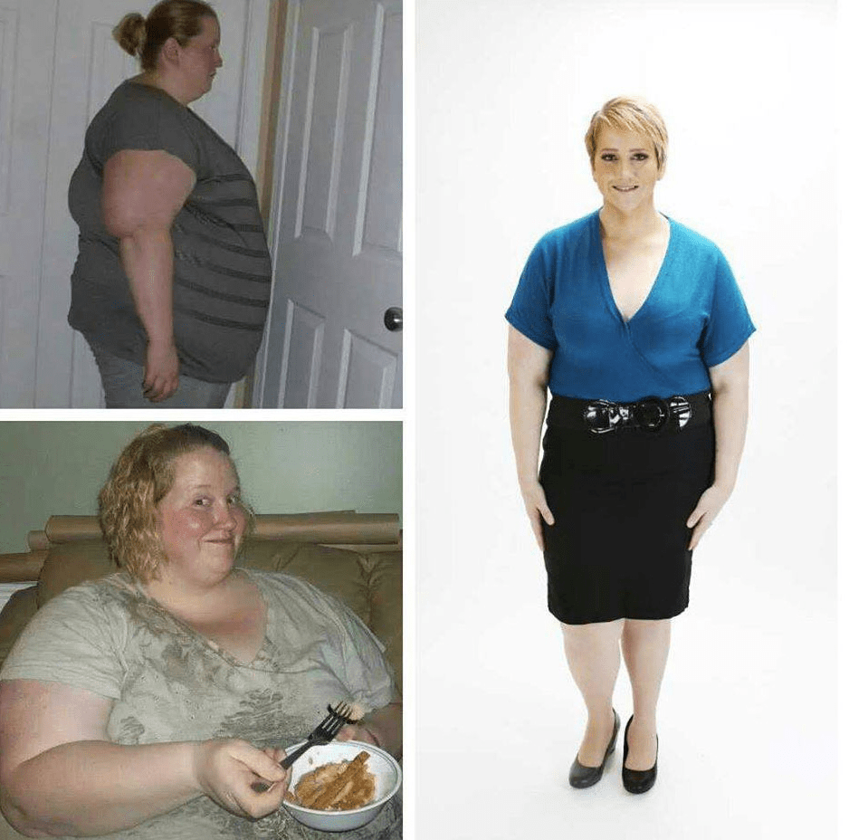 7+ Resultados Manga Gastrica