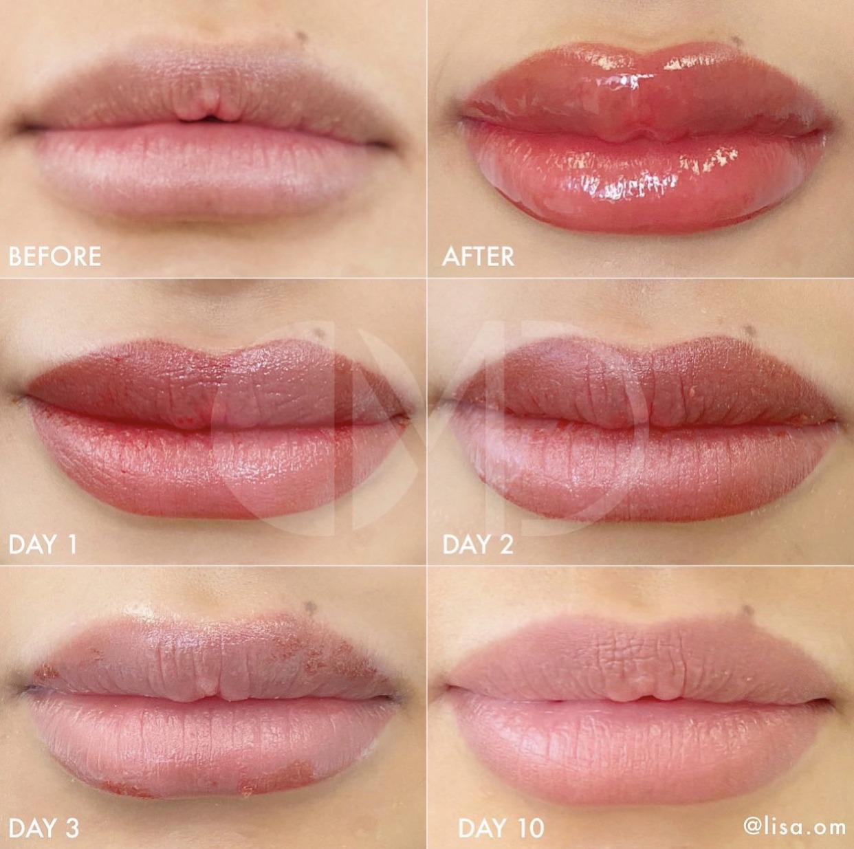 20231217 1Day ATLANTA PMU Lip Blush Training LISA OM®