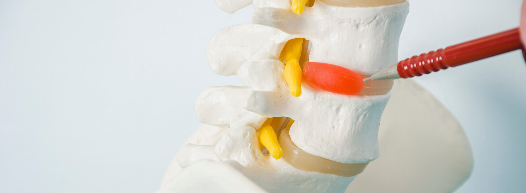 Disc Herniation Treatment & Physical Therapy Great Neck, East Meadow