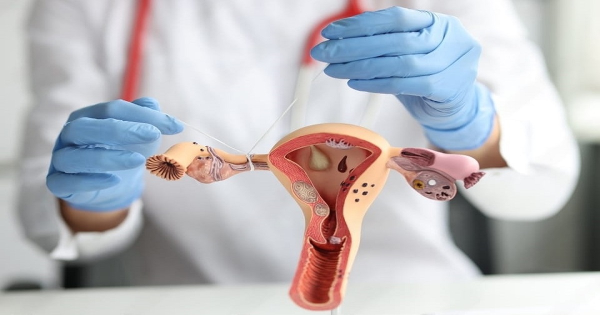 Blocked Fallopian Tubes Symptom, Cause, Diagnosis & Treatment