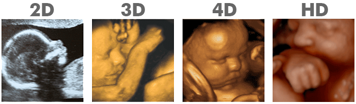 Best Time For 3d Ultrasound Reddit Regis Prog Rais