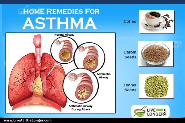 Home Remedies To Relieve Asthma Attacks Live A Little Longer