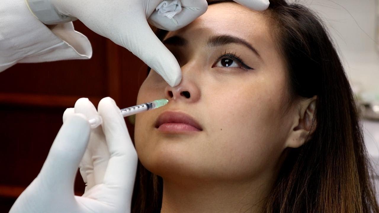 Q&A by Aesthetic Doctors on Nose Threads in Singapore Live Enhanced
