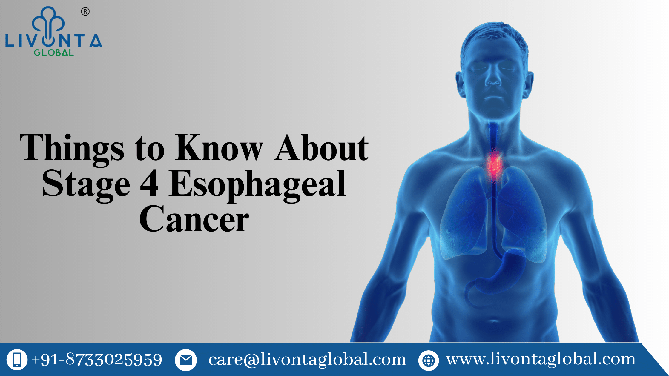 Things to Know About Stage 4 Esophageal Cancer Livonta Global Pvt Ltd