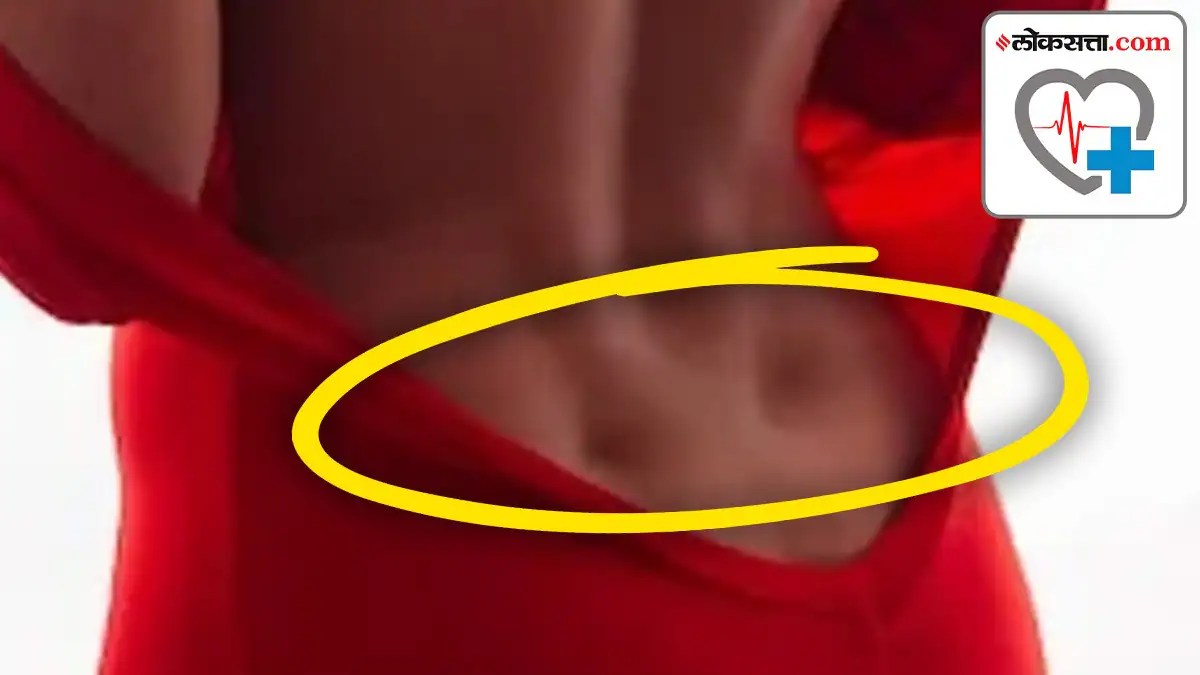 तुमच्या पाठीवर ‘व्हीनस होल्स’ असणे हे उत्तम आरोग्याचे लक्षण आहे का