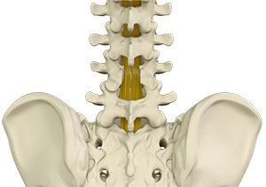 Laminectomie Lombaire: Déroulement Et Alternatives (Vidéo Incluse)