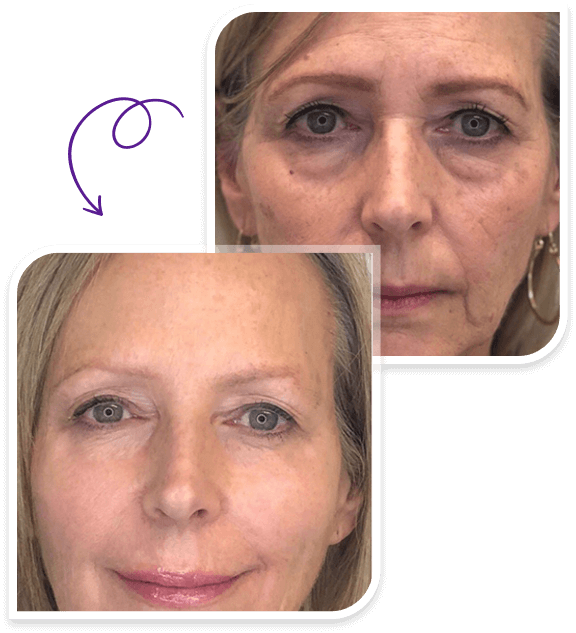 Ageless II Reviews A NEW! Ageless Skin Care Supplement